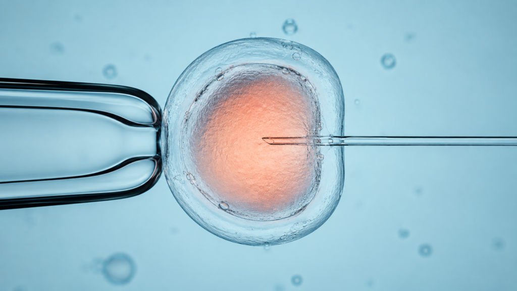 Ilustración científica de una ICSI con un ovocito sostenido por una pipeta y un espermatozoide dentro de la micropipeta de inyección.