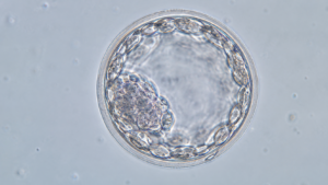 Imagen microscópica de un blastocisto humano con la masa celular interna, el blastocele y el trofoectodermo visibles.